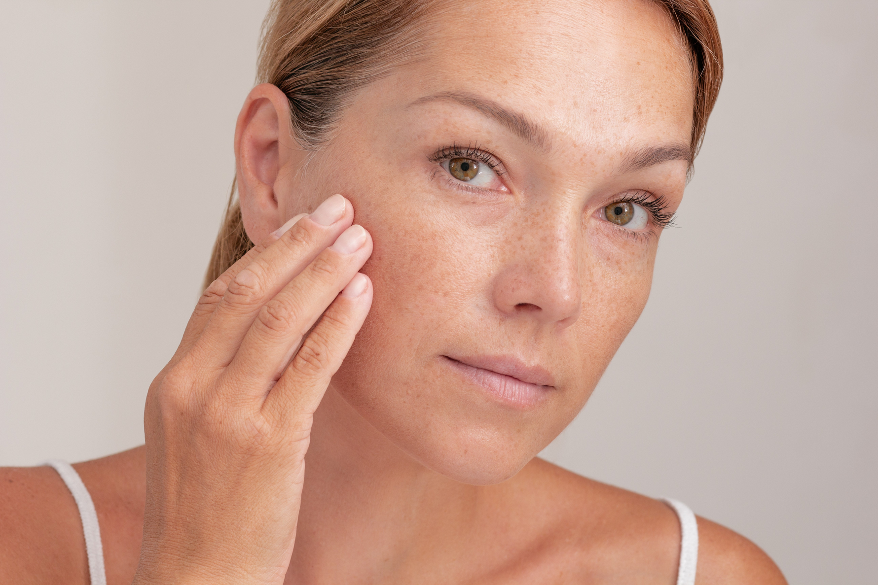 Anti-Spot and Lightening Advice