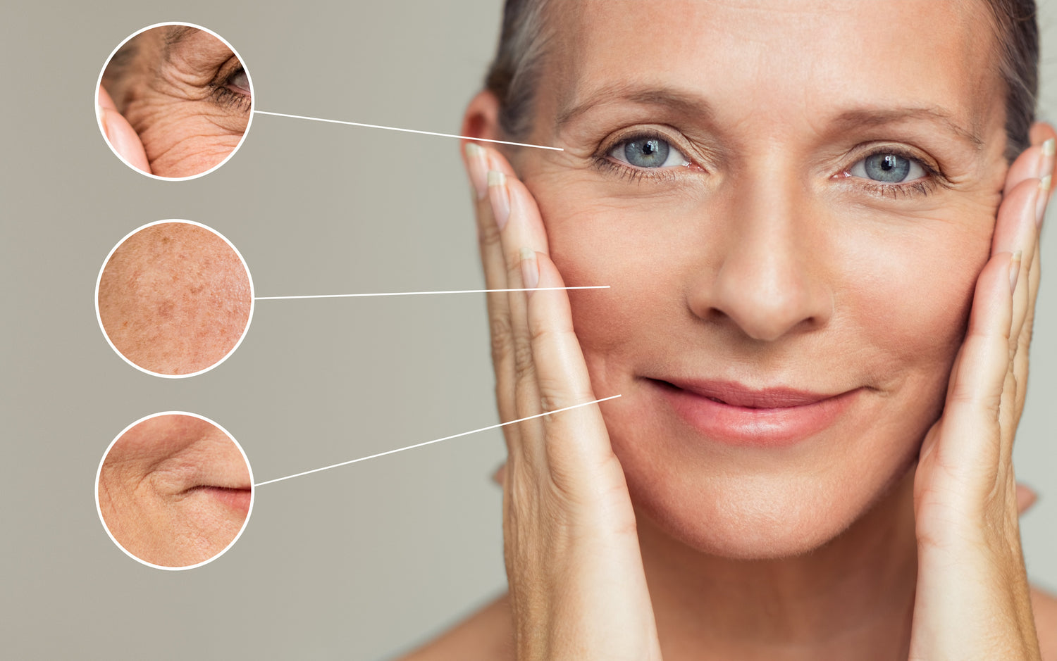 Multiple Signs of Aging
